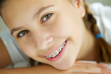 Orthodontist in Jackson & Battle Creek, MI - Early Treatment